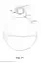 Fig. 26 - Portably suspended retractable shelf