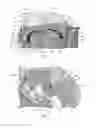 Fig. 06 - Tamper Resistant Hot Pot