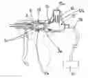 Fig. 01 - Ergonomic handpiece for laparoscopic and open surgery