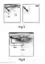 Fig. 04 - Medical apparatus and its visualisation