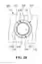 Fig. 04 - Bone plate system