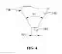 Fig. 06 - Bone plate system