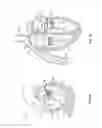 Fig. 02 - METHODS, SYSTEMS AND DEVICES FOR CARDIAC VALVE REPAIR