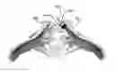 Fig. 01 - BONE IMPLANTS FOR ORTHOPEDIC PROCEDURES AND CORRESPONDING METHODS