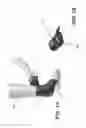 Fig. 02 - Pressure-sensing compression bandage