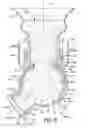 Fig. 10 - Measured fluid dispenser