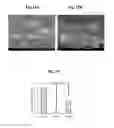 Fig. 13 - Pharmaceutical formulations containing mitochondrially targeted antioxidants