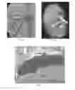 Fig. 02 - Polymeric treatment compositions