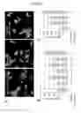 Fig. 09 - ANTIBODY DEPENDENT EXOSOME THERAPY