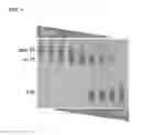 Fig. 02 - METHODS AND COMPOSITIONS FOR INCREASING HEPCIDIN EXPESSION USING MODIFIED IRON BINDING/RELEASING TRANSFERRIN