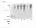 Fig. 03 - METHODS AND COMPOSITIONS FOR INCREASING HEPCIDIN EXPESSION USING MODIFIED IRON BINDING/RELEASING TRANSFERRIN