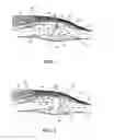 Fig. 02 - Pharmaceutical gels and methods for delivering therapeutic agents to a site beneath the skin
