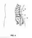 Fig. 04 - Pharmaceutical gels and methods for delivering therapeutic agents to a site beneath the skin