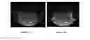 Fig. 53 - Imaging beta-amyloid peptides aggregation