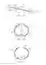 Fig. 02 - Systems and methods of treating malacia by local delivery of hydrogel to augment tissue