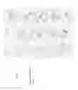 Fig. 07 - Methods and systems for treatment of spinal disorders using trans-spinal direct current stimulation