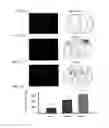 Fig. 17 - Methods and systems for treatment of spinal disorders using trans-spinal direct current stimulation