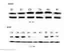 Fig. 20 - Methods and systems for treatment of spinal disorders using trans-spinal direct current stimulation