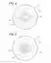 Fig. 05 - Blow molding device