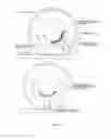 Fig. 07 - Compression Tires and Tire Systems