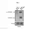 Fig. 02 - TREATING DISEASES ASSOCIATED WITH PGC1-ALPHA BY MODULATING MICRORNAS MIR-130A AND MIR-130B