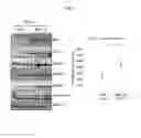 Fig. 08 - TREATING DISEASES ASSOCIATED WITH PGC1-ALPHA BY MODULATING MICRORNAS MIR-130A AND MIR-130B