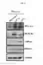 Fig. 16 - TREATING DISEASES ASSOCIATED WITH PGC1-ALPHA BY MODULATING MICRORNAS MIR-130A AND MIR-130B