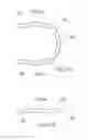 Fig. 26 - Attachment structure of fuel injection device nozzle plate