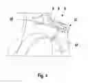 Fig. 05 - Internal combustion engine with settable variable compression ratio and with a switching module