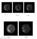 Fig. 08 - MEDICAL IMAGING SYSTEMS AND METHODS FOR PERFORMING MOTION-CORRECTED IMAGE RECONSTRUCTION