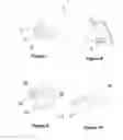 Fig. 06 - Earphone device with optical sensor