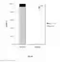 Fig. 49 - Animal models and therapeutic molecules