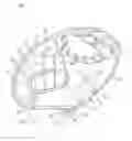 Fig. 01 - BALL GLOVE THUMB GUARD DEVICE