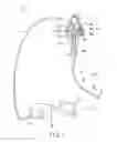 Fig. 02 - Passive bending section for endoscope, and endoscope