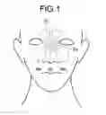 Fig. 02 - Insertion method