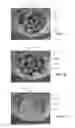 Fig. 08 - Full-eye illumination ocular surface imaging of an ocular tear film for determining tear film thickness and/or providing ocular topography