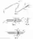 Fig. 02 - SYSTEM AND METHOD FOR DELIVERING EXPANDING TROCAR THROUGH A SHEATH