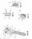 Fig. 05 - Flexible spinal stabilization system and method