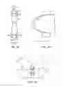 Fig. 02 - Dynamized interspinal implant