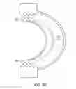 Fig. 09 - Dynamized interspinal implant
