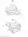 Fig. 02 - Dental impression model system, apparatus, and method