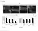 Fig. 06 - Methods and compositions for preserving photoreceptor and retinal pigment epithelial cells