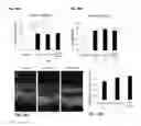 Fig. 22 - Methods and compositions for preserving photoreceptor and retinal pigment epithelial cells