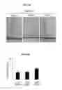 Fig. 35 - Methods and compositions for preserving photoreceptor and retinal pigment epithelial cells