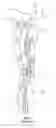 Fig. 03 - Re-entry catheters and related methods