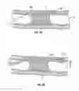 Fig. 05 - Re-entry catheters and related methods