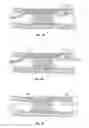 Fig. 06 - Re-entry catheters and related methods