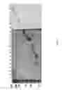 Fig. 07 - SYSTEM AND METHOD FOR HIGH THROUGHPUT MASS SPECTROMETRIC ANALYSIS OF PROTEOME SAMPLES