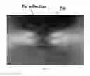 Fig. 08 - Multiple Integrated Tips Scanning Probe Microscope