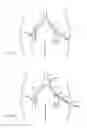 Fig. 07 - Bilateral vessel closure